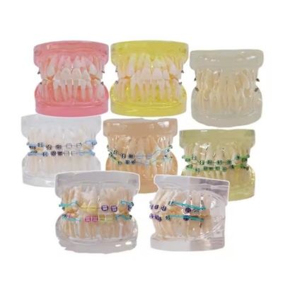 โมเดลฟันมนุษย์หลายสีสําหรับการศึกษา โมเดลฟัน Orthodontic ฟันฟันที่มีบราคเก็ต