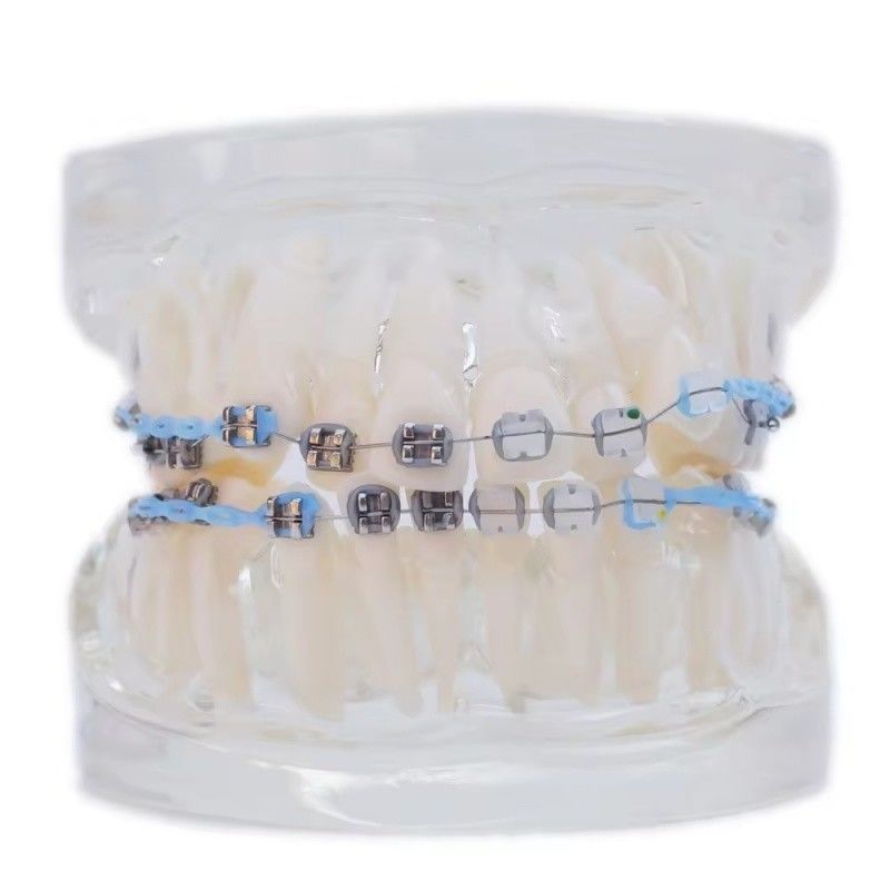 โมเดลฟันมนุษย์หลายสีสําหรับการศึกษา โมเดลฟัน Orthodontic ฟันฟันที่มีบราคเก็ต